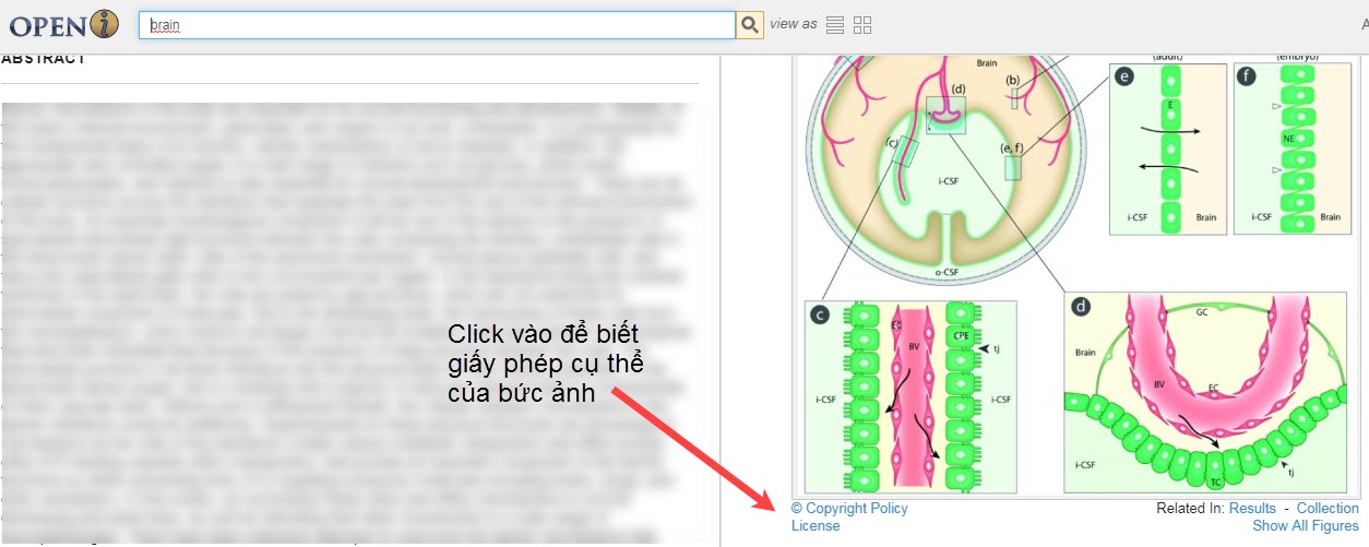 kho ảnh y tế miễn phí của NIH