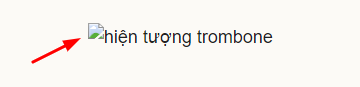 ảnh không hiển thị trên website